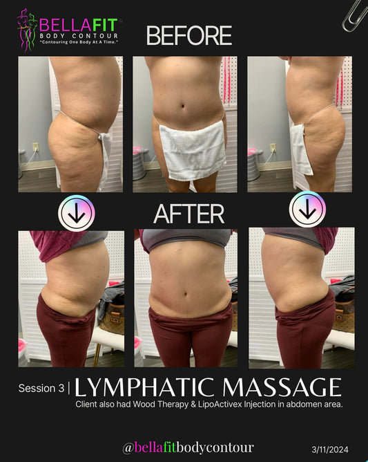 Before & After Lymphatic Massage